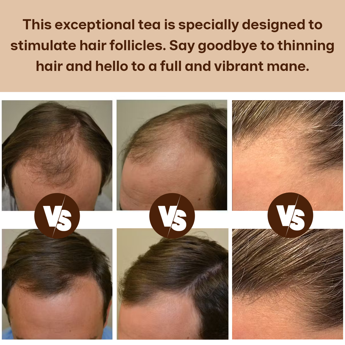 Hair Growth Tea — Natural Hair Nourishment Blend