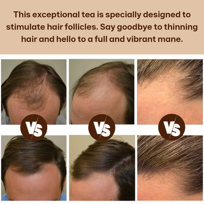 Hair Growth Tea — Natural Hair Nourishment Blend